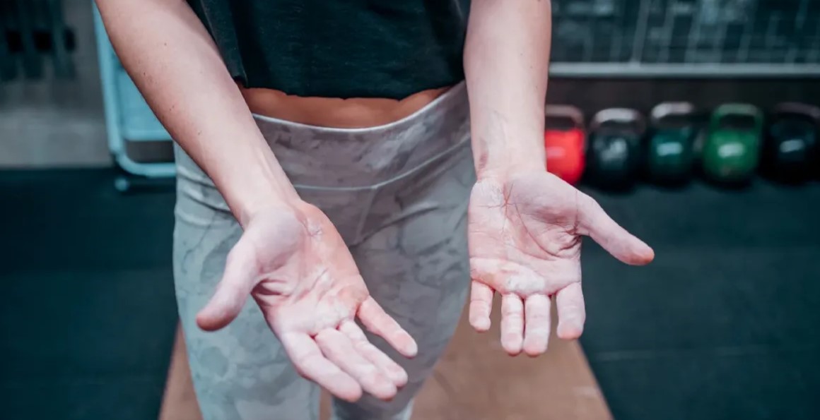 How to Address Hand Calluses?